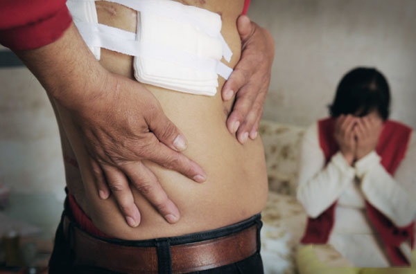 安徽男子手术后右肾离奇失踪