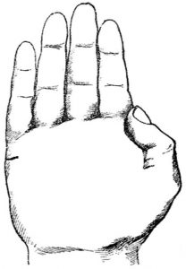 极短的婚姻线