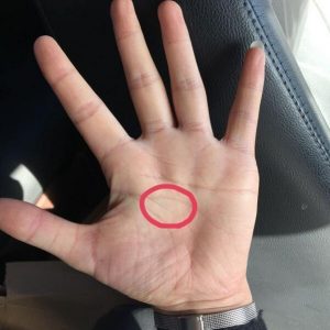 人纹分叉容易因为想的太多而分心