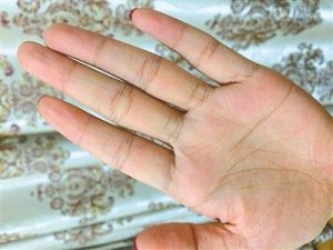 手掌又硬又茧的人