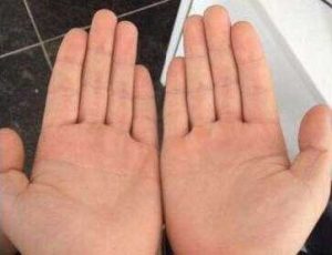 手指头又短又粗的人