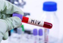 全球首位女性艾滋病“治愈”者出现，研究人员称这一说法需谨慎_桂启洪个人网站