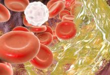 胆固醇是健康的“隐形杀手”还是被冤枉的“免疫功臣”?_桂启洪个人网站