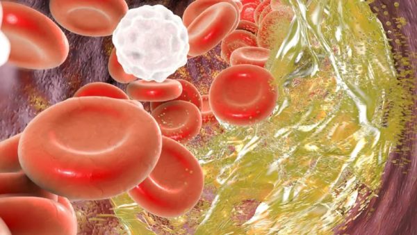 胆固醇是健康的“隐形杀手”还是被冤枉的“免疫功臣”?